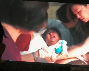 现场直播揪痧